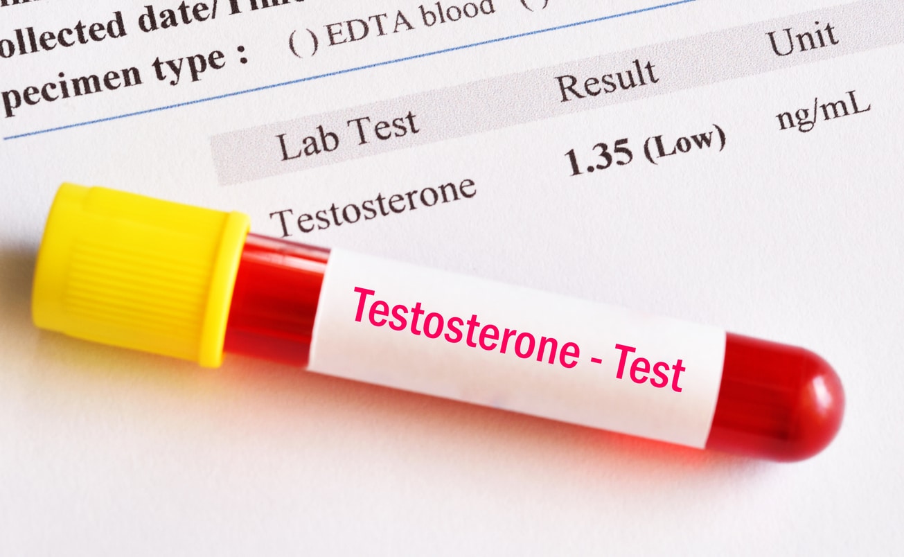 A test tube labeled with the word testosterone, commonly used in testosterone replacement therapy.