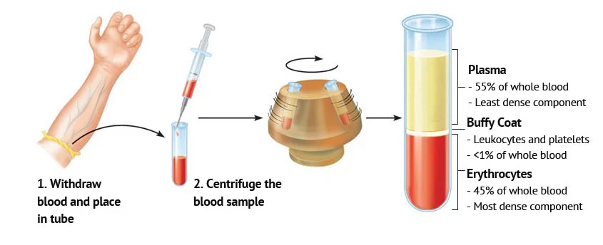 Illustration showing the process of blood separation: a syringe drawing blood from an arm, blood in a tube being centrifuged, with labeled layers of plasma, buffy coat, and erythrocytes.