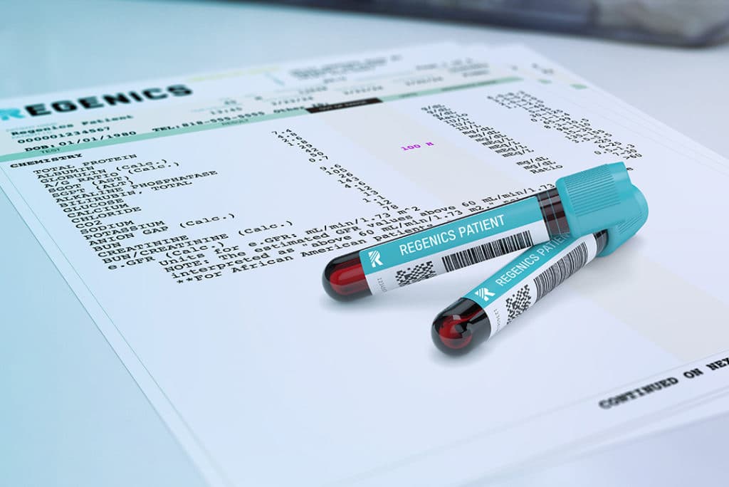 Two labeled blood sample tubes rest on a printed medical lab results sheet, highlighting REGENICS's commitment to precision and care.