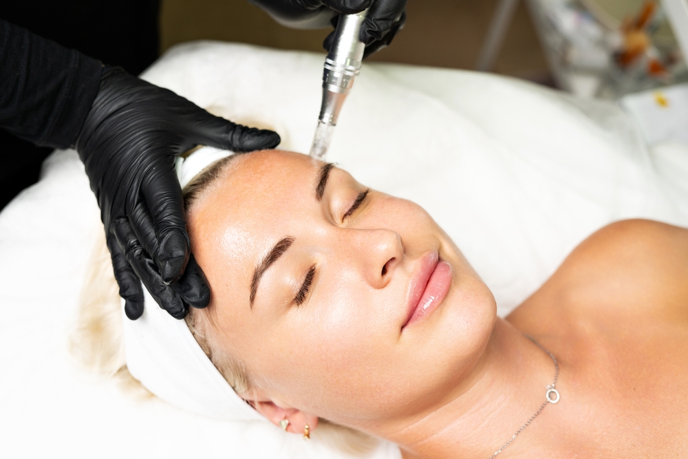 Microneedle RF lifting procedure. A cosmetologist performs a facial rejuvenation procedure on a woman