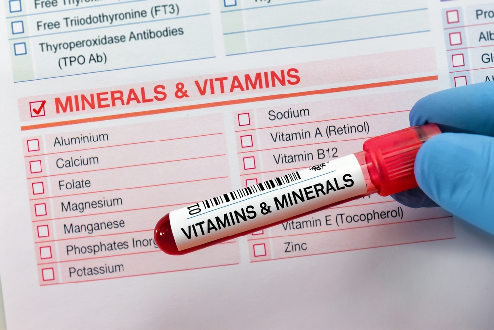 Blood tube test with requisition form for vitamins and minerals test