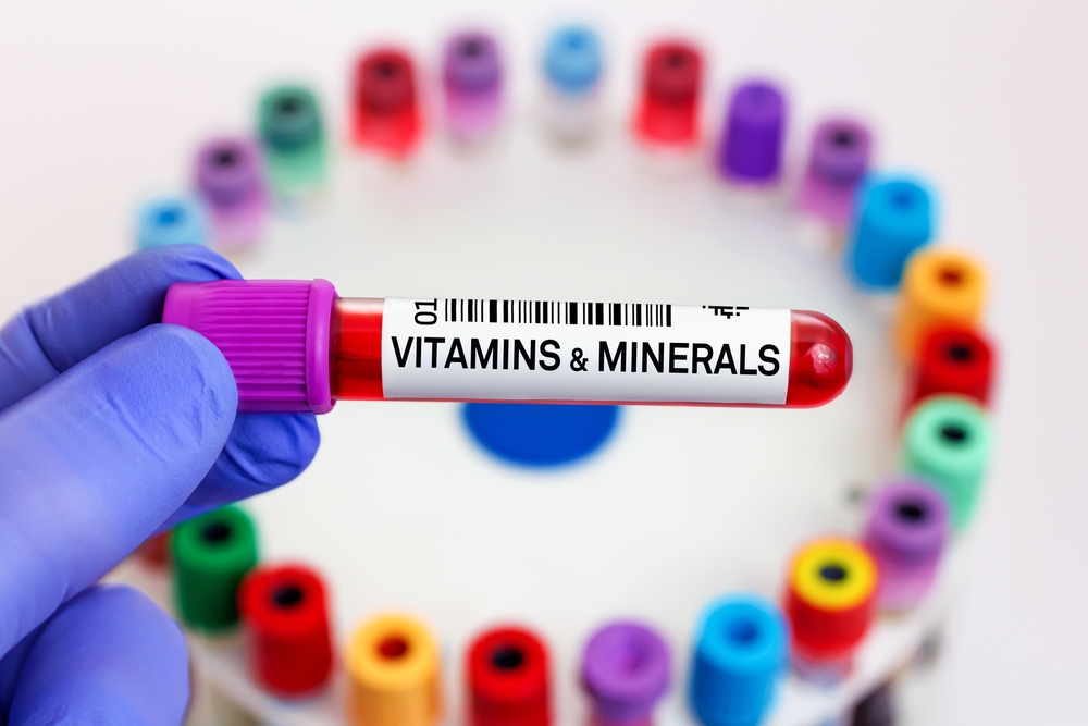 Blood sample of patient for Vitamins and minerals test in laboratory