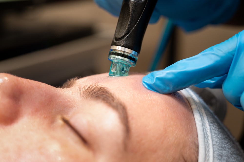 A person is receiving a Hydrafacial treatment, with a blue-gloved hand gently holding a device against their forehead.