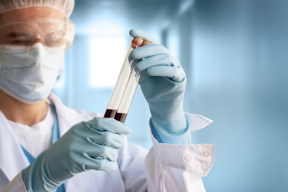 Technician holds laboratory blood panel sample test tube